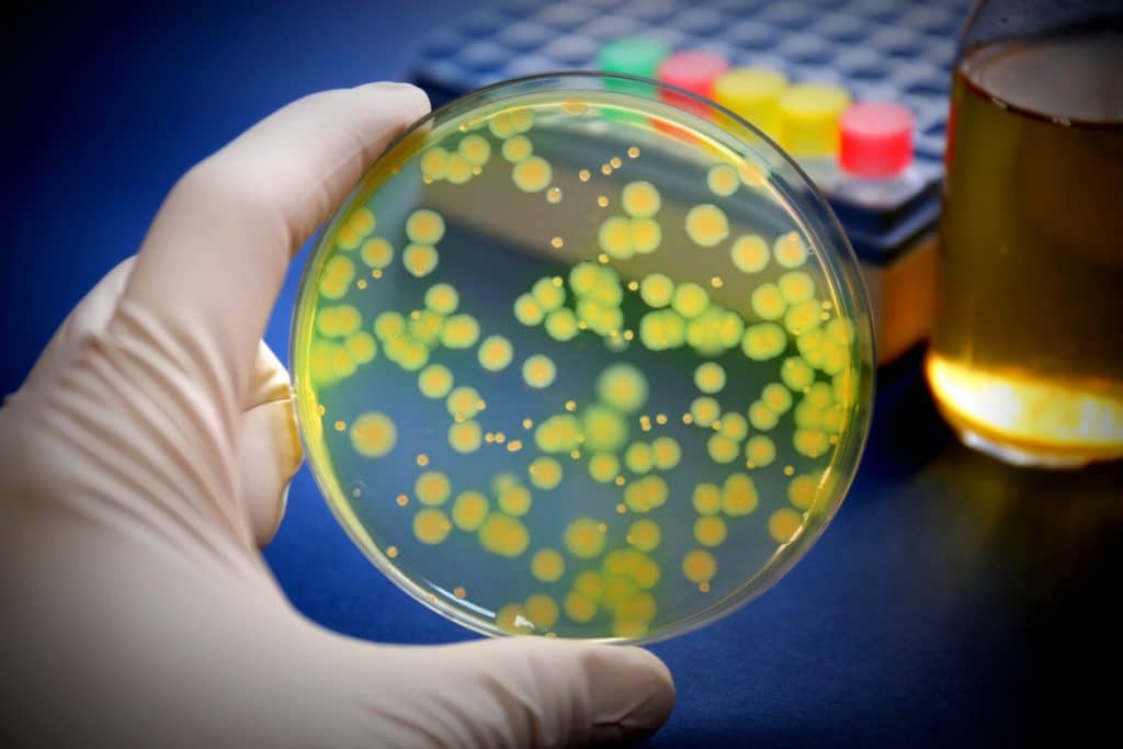 Pseudomonas Aeruginosa