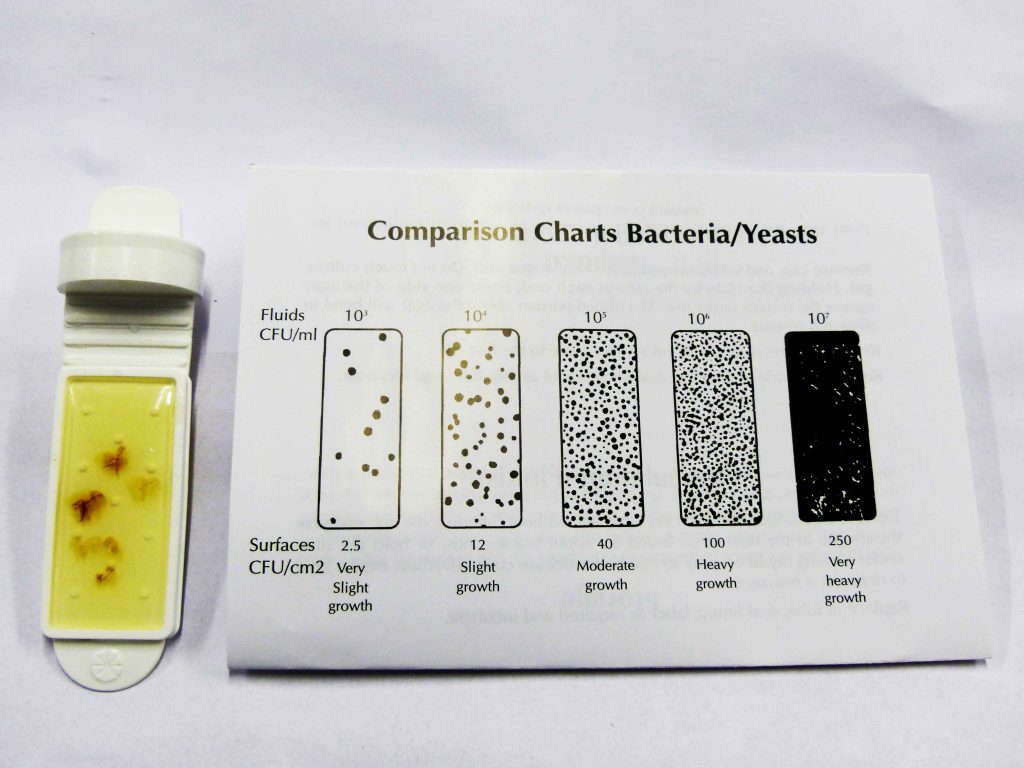 Bacteria Dip Slide Chart